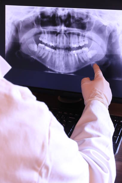 Best Emergency Dentist for Knocked-Out Tooth in Summerville, GA