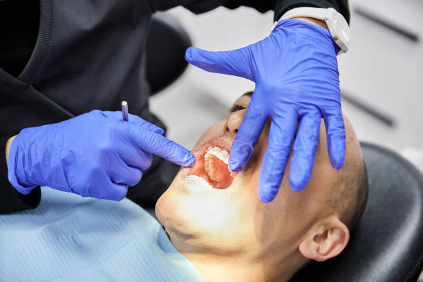 Best Emergency Dental Care for Abscessed Tooth in Summerville, GA