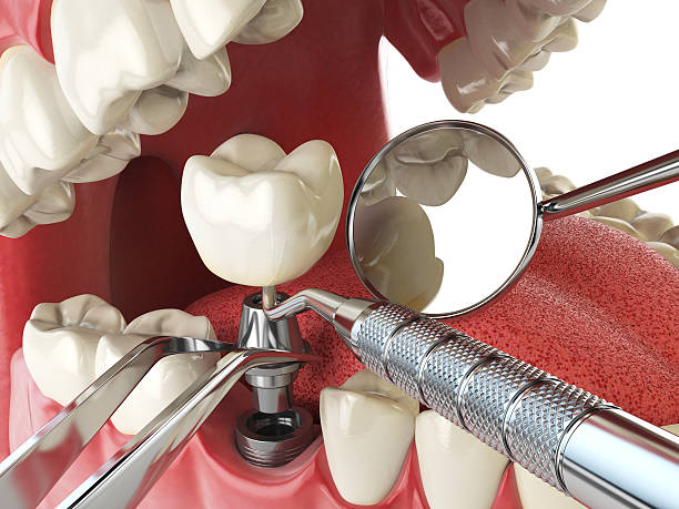 Best Pediatric Emergency Dentist in Summerville, GA